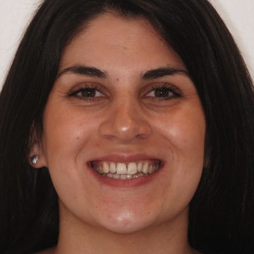 landing-page-default-3-before-360×360 landing-page-default-3-before-360x360