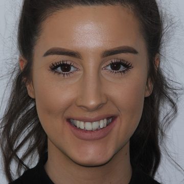 landing-page-default-4-before-360×360 landing-page-default-4-before-360x360